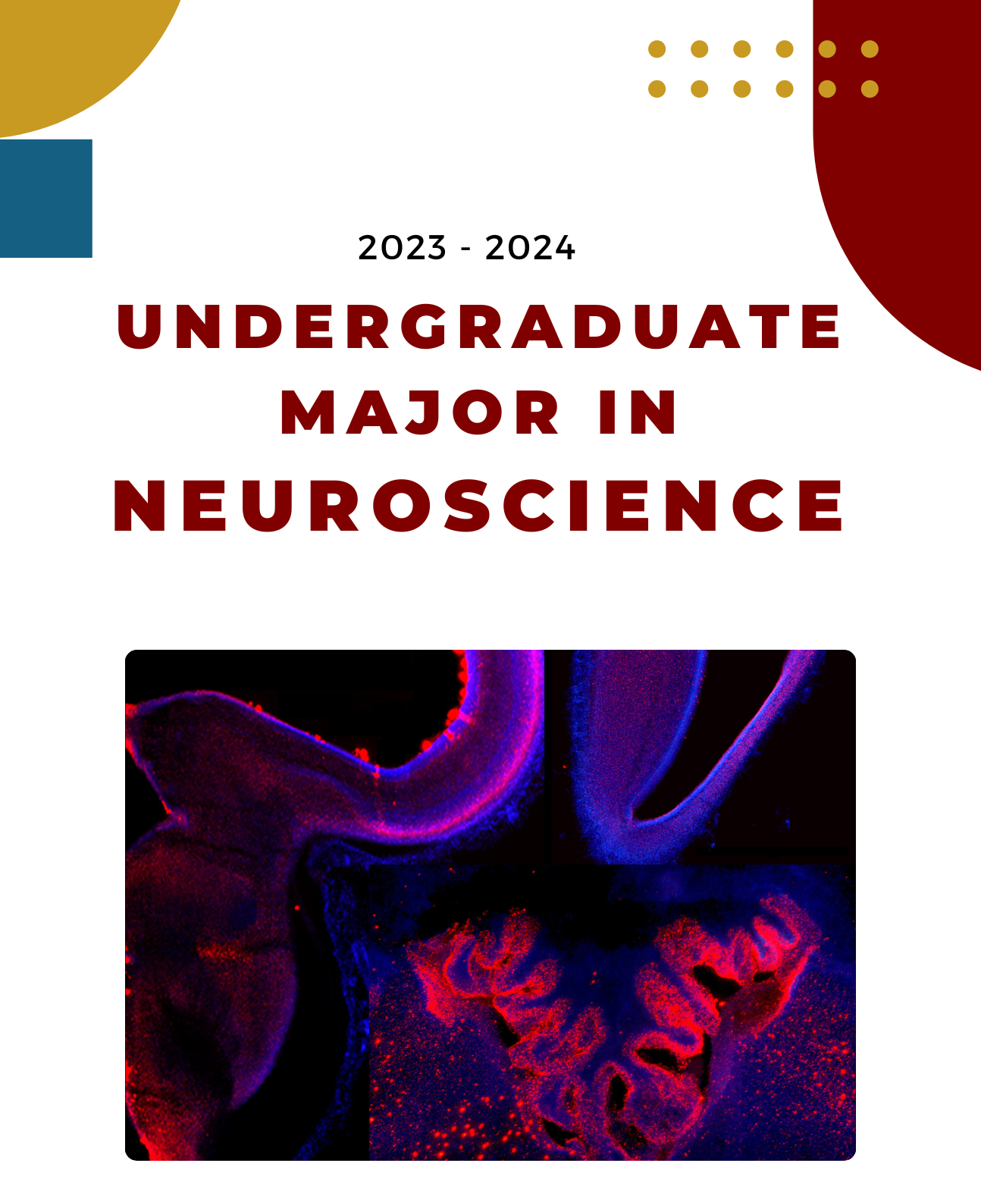 Neuroscience Undergraduate Degree University Of Chicago